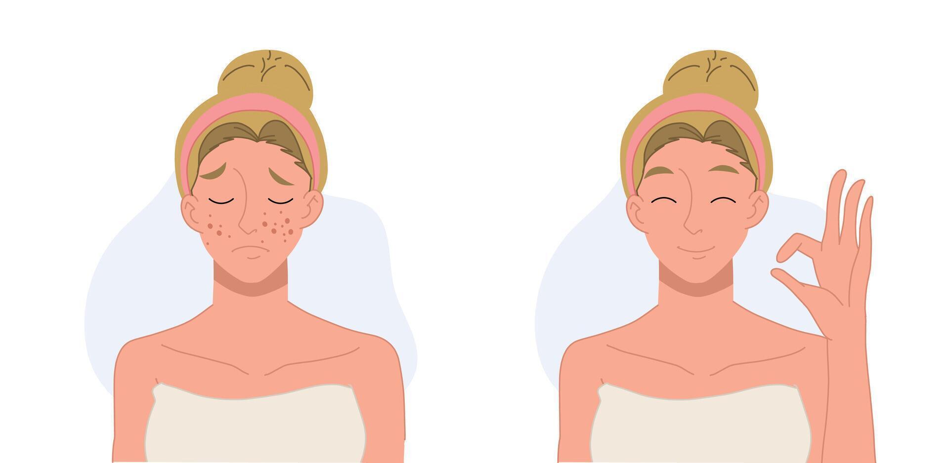 Skin care concept.woman,girl with acne. Before and after acne.Flat cartoon character illustration. vector