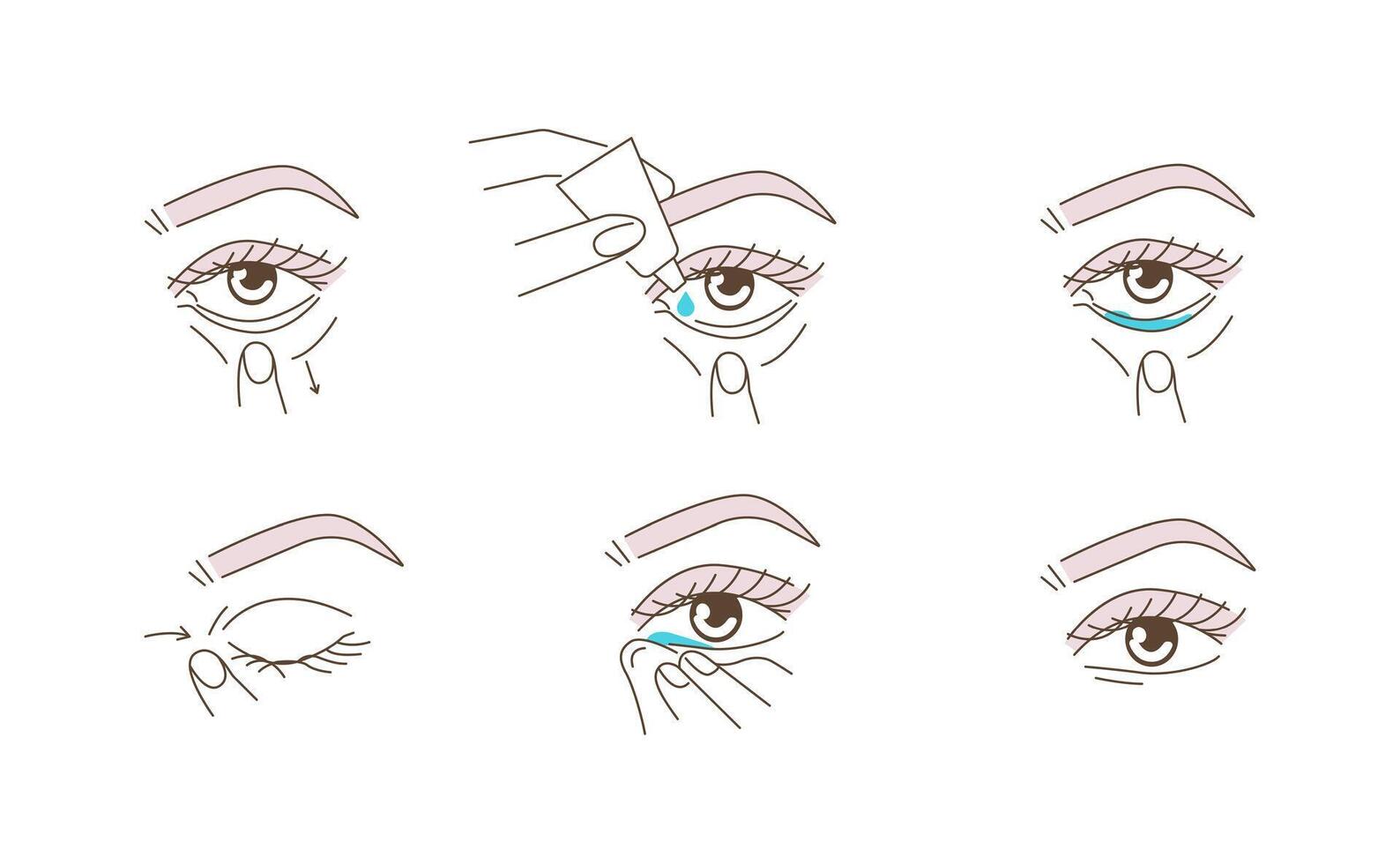 Woman Using Eye Drops Bottle. Instruction how to Correctly Applying Eyedrops. Ophthalmology Healthcare against Redness, Allergy, Dry Eyes vector
