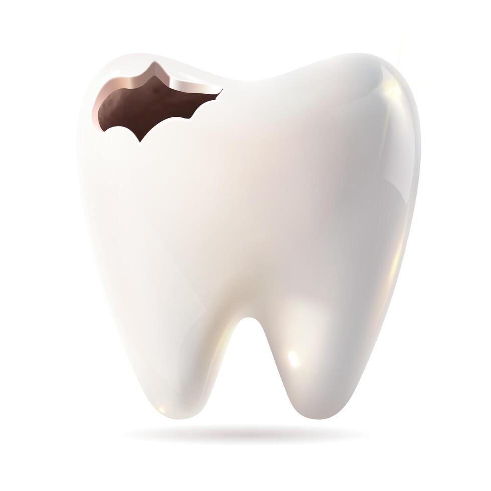 A tooth exhibiting a noticeable hole in it against a white background vector
