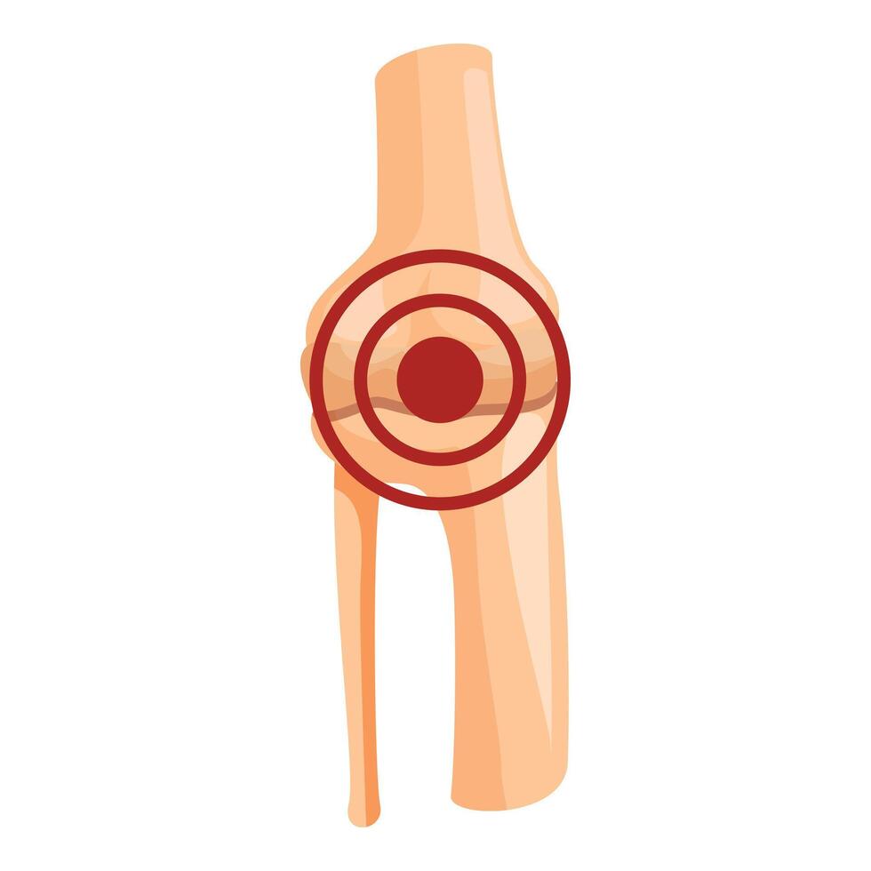 Knee pain highlighted by red circle indicating joint inflammation vector