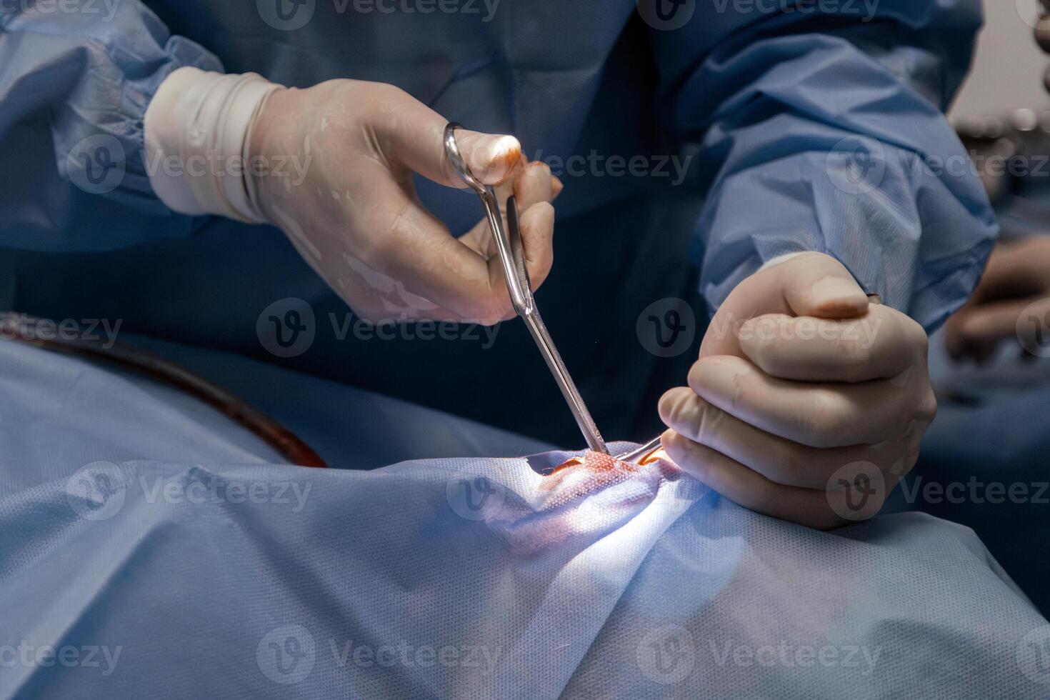 Surgical hands in sterile gloves performing an operation with precision instruments on a patient, showcasing the intricate details of medical procedures and teamwork in a clinical environment photo