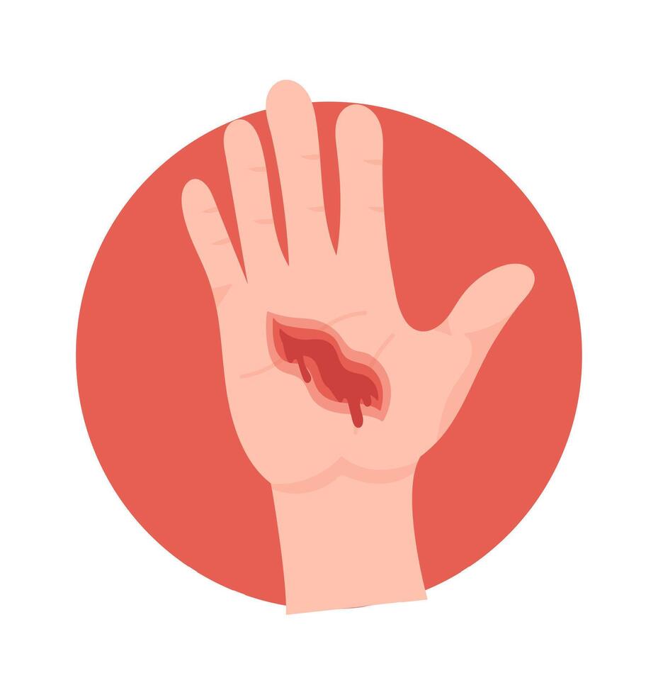 Large And Deep Hand Wound vector