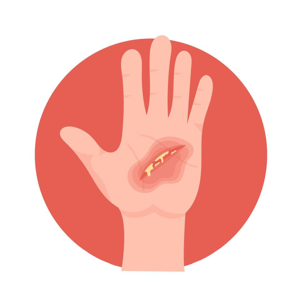 Signs Of Infection On Hand Wound vector