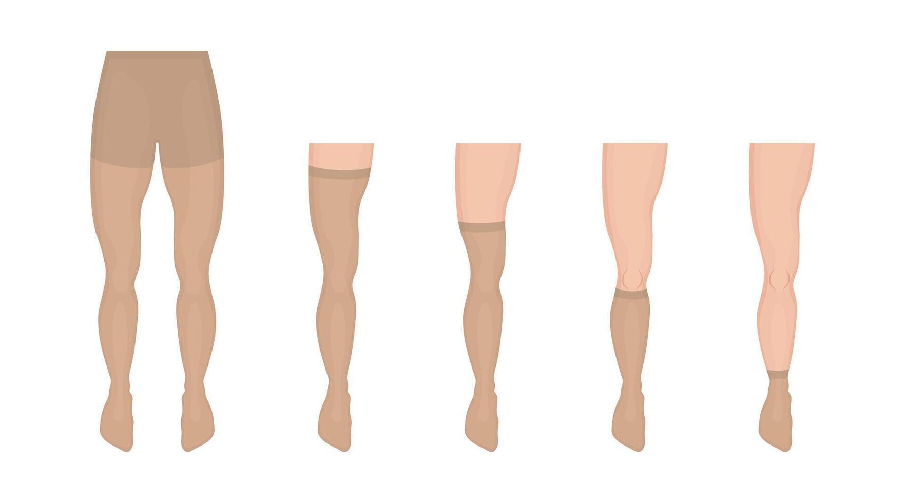 Medical compression hosiery helps improve blood circulation in legs, preventing swelling and relieving pain, designed for people with varicose veins, edema, or those recovering from surgery vector
