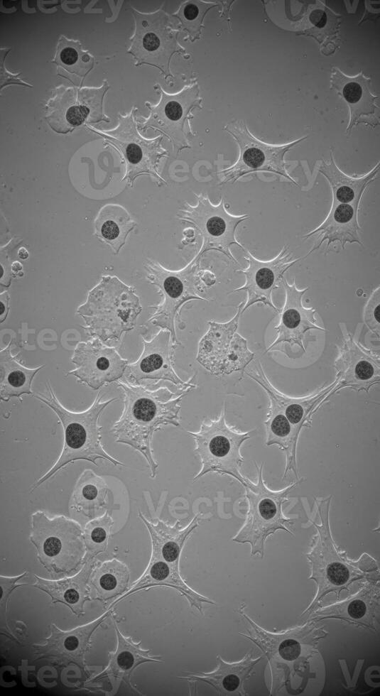 Microscopic view of cells with dark centers and irregular shapes spread across a gray background photo
