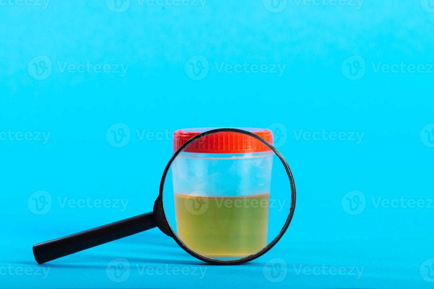 Urine analysis under a magnifying glass on a blue background. Concept of urine testing for infections and leukocytes in urology. Copy space for text photo