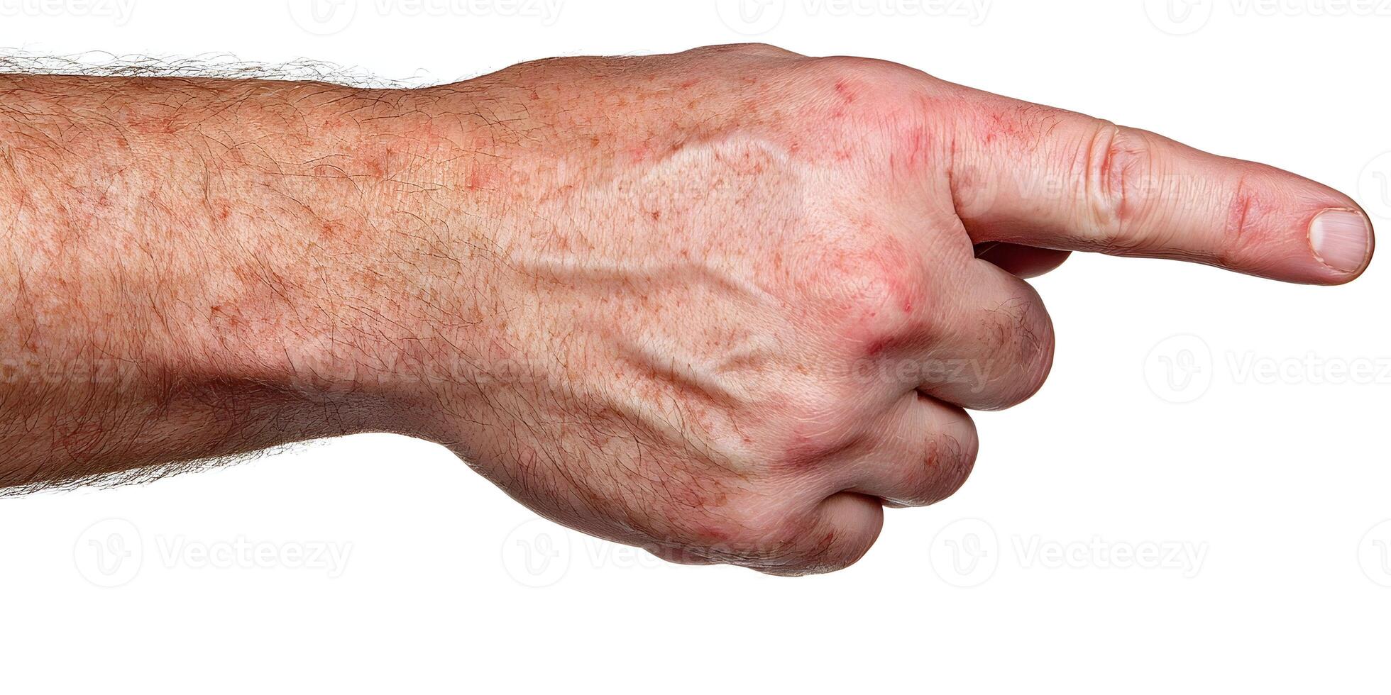 A males hairy hand with visible veins and some redness points right with an extended index finger on a white background photo