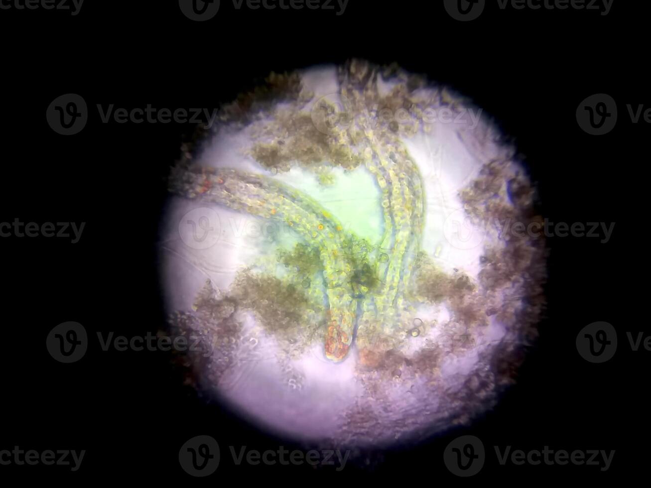 Microscopic View of Nematode Germs Displaying Distinctive Structures and Movement Patterns photo