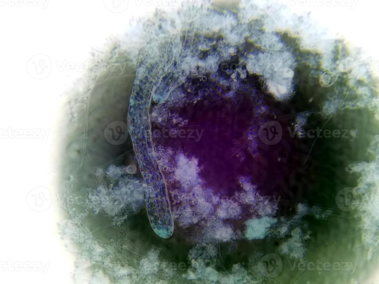 Observation of Nematode Germs Under a Microscope Revealing Intricate Details of Their Structure photo