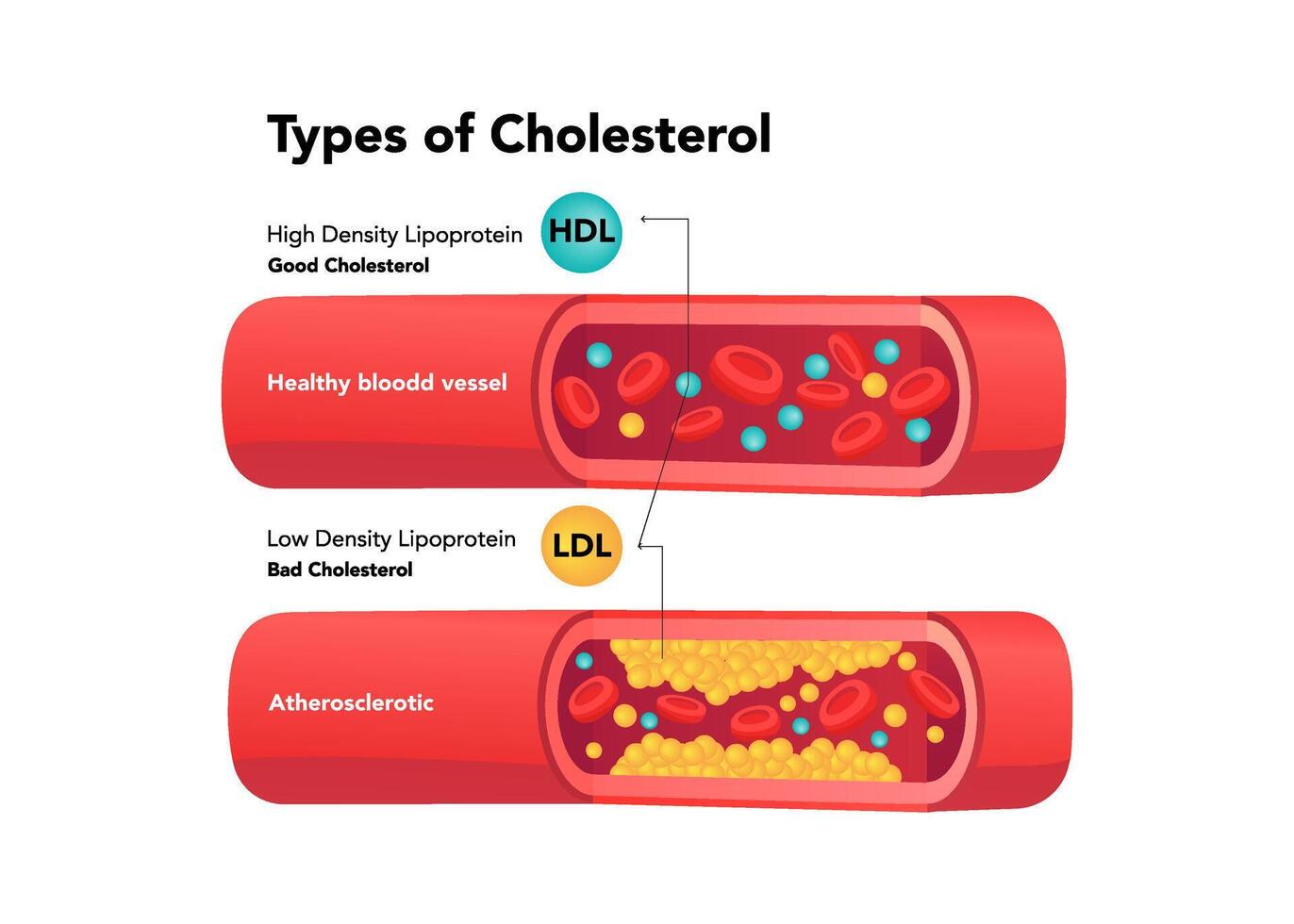tipos de colesterol comparación con hdl y ldl valores ilustración vector