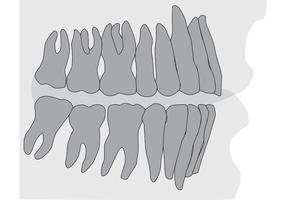 Teeth and Gums Xray  vector