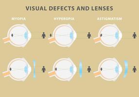 Defectos visuales y lentes vectoriales vector