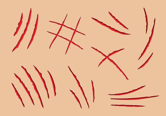 Scracth Marks