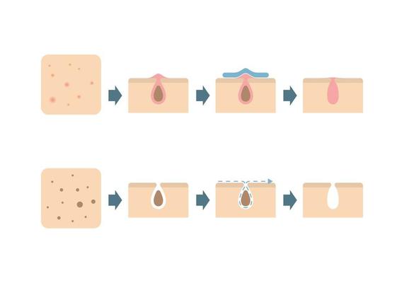 Skin Problems Icons