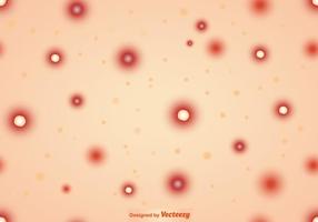 Vector Pimples On Skin Seamless Background