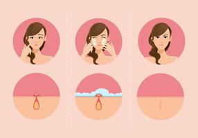 Girls And Pimples Free Vector