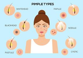 Free Type of Pimple Vector