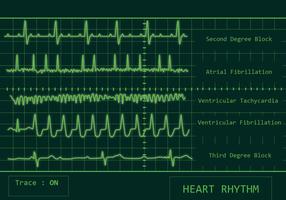 Heart Rhythm Vector Pack