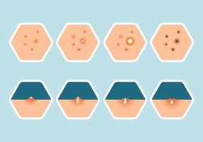 Pimple Icons Set vector