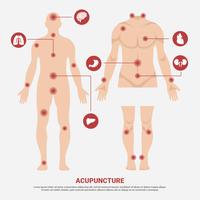 Acupuncture Point in Man Body Vector Illustration