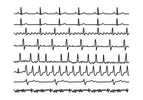 Gráfico de ritmo cardíaco Vector libre