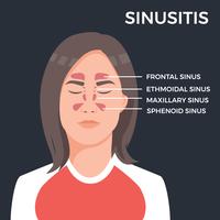 Vector Sinus illustration