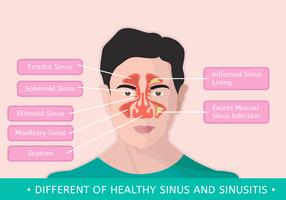 Diferente del seno sano y la sinusitis vector
