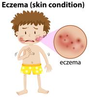 Un chico joven que tiene eczema vector