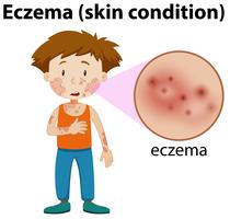 eczema magnificado en chico joven vector