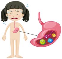 Girl with bacteria in stomach vector