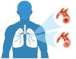 Human Lung on White Background vector