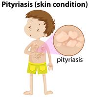 magnified pityriasis on young boy vector