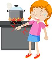 A girl with burned arm vector