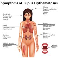 Human Anatomy Symptoms of Lupus Erythematosus vector