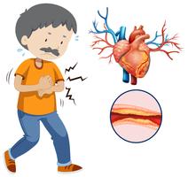 A Human Heart Problem on White Background vector