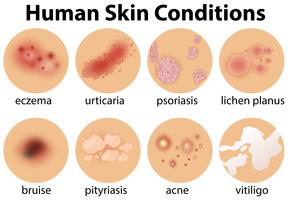 Un conjunto de condiciones de la piel humana