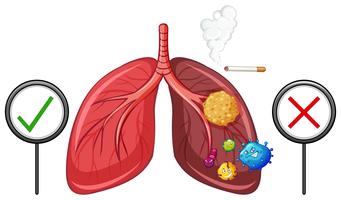 Diagrama que muestra los pulmones sanos y no saludables. vector