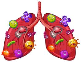 Un vector de bacterias pulmonares