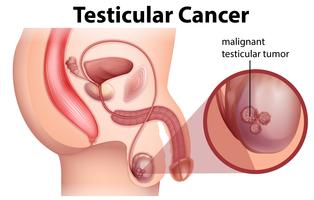Anatomía masculina del cáncer de testículo vector