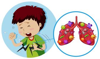 Young boy with bacteria on lungs vector