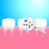 Un diente con caries dental y dolor. vector