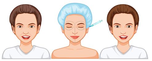 Comparación de inyección de botox femenino vector