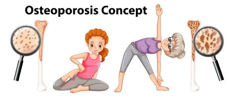Osteoporosis concept on white background vector