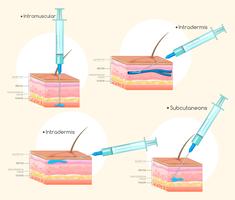 Different types of injections vector