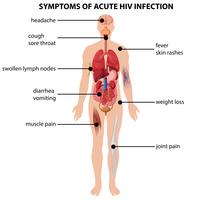 Diagram showing symptoms of acute HIV infection