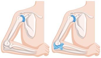 Close up diagram of human elbow joints vector
