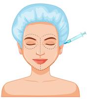 Mujer botox relleno de piel inyectable vector