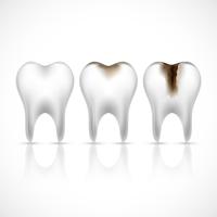 Conjunto realista de dientes. vector