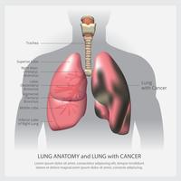 Lung with Detail and Lung Cancer Vector Illustration