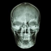 cráneo de rayos x (asiático)
